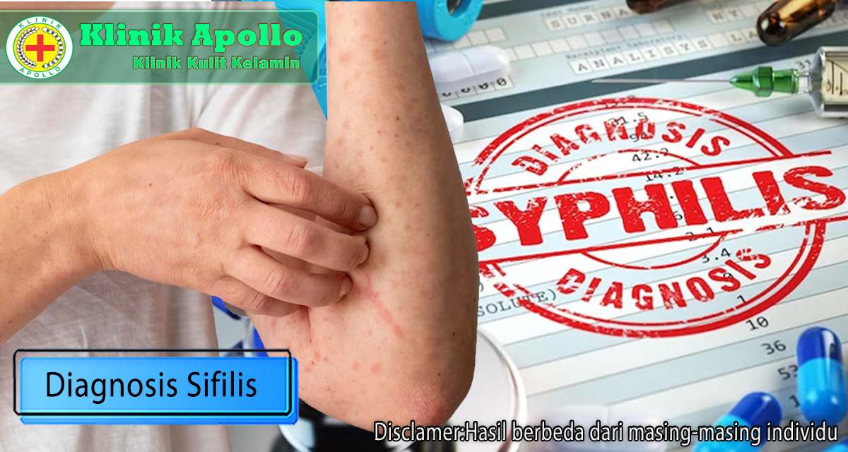 Diagnosis Sifilis